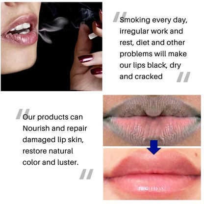 Remove Dark Lip Balm Lightening Melanin Mask Gloss